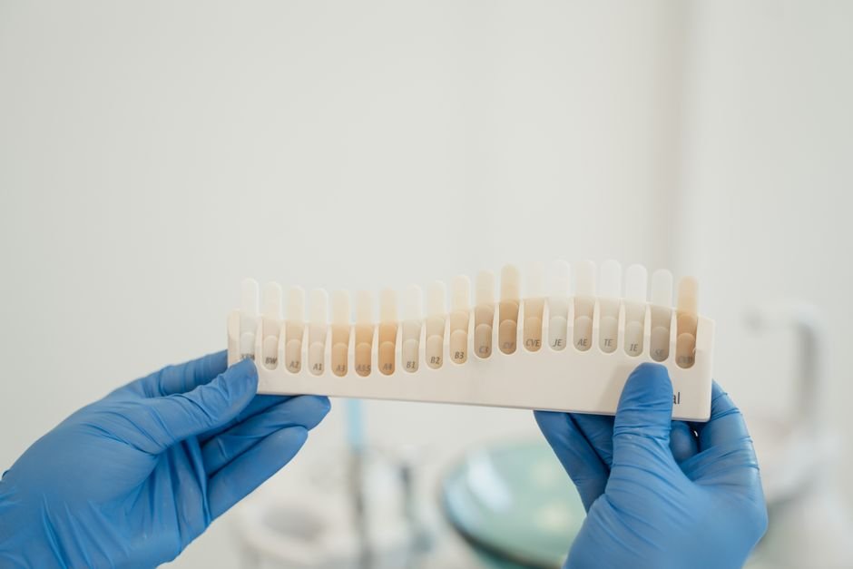 Cosmetic Fixes for Gaps Between Teeth
