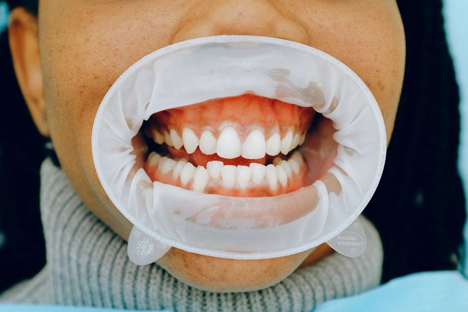 Understanding Gum Health and Why It Matters