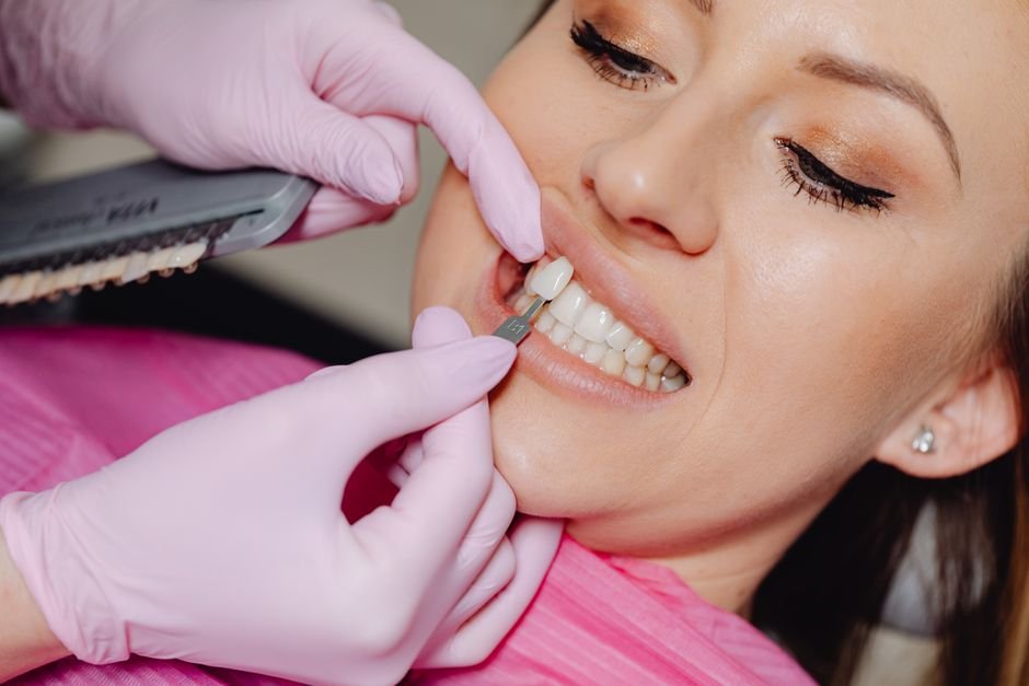 Understanding the Difference Between Veneers and Crowns